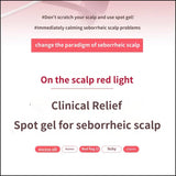 Dr.Groot Clinical Relief Scalp Spot Gel (80ml)